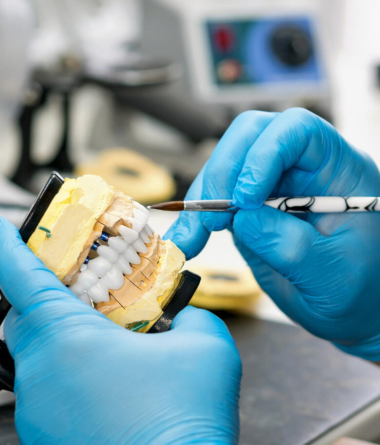 Cirkonske krunice – Dental Adriatic Cirkonske zubne krunice izrađene u Dental Adriatic laboratoriju