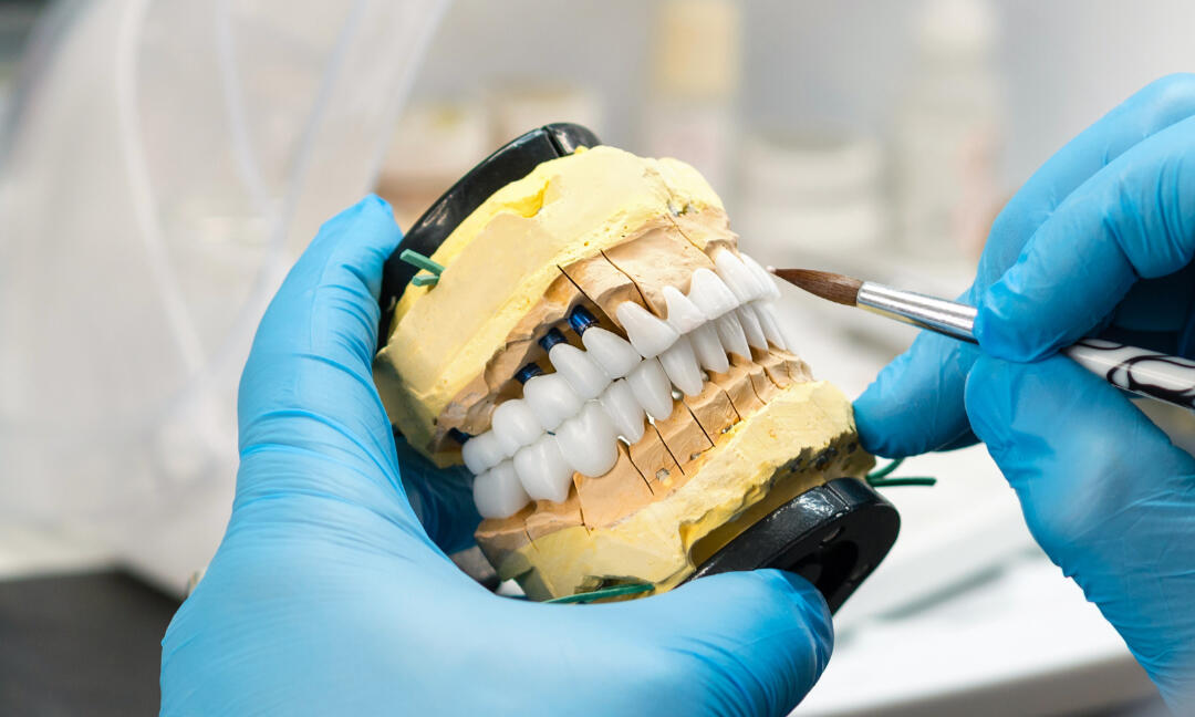 Cirkon za dentalne ordinacije Cirkonske krunice za stomatološke ordinacije po cijeni od 40 eura po jedinici